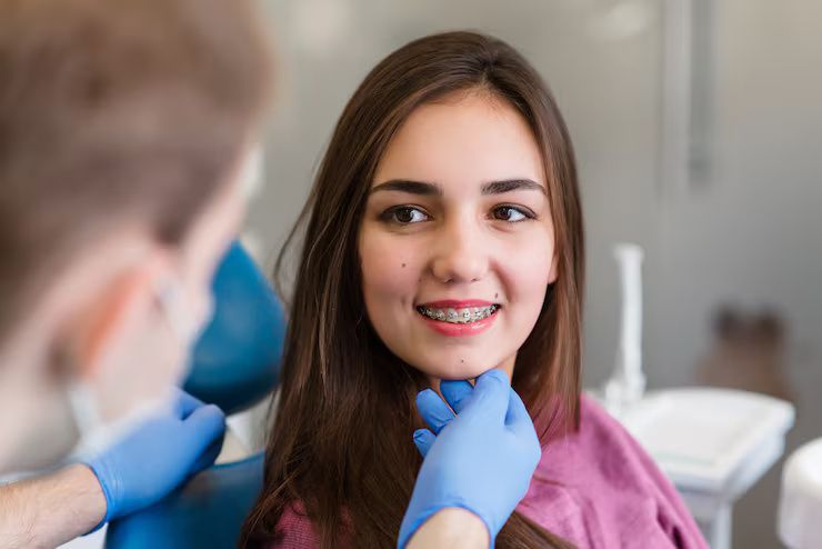 Dental Clips in Orthodontic Dental Clips in Orthodontic